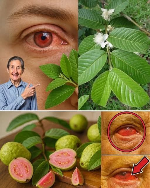 Guava for Eye Health: The Tropical Fruit That Helps Protect Your Vision Naturally sn
